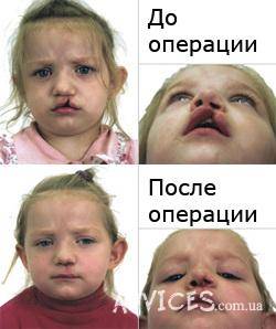 ��������� ������������� �������� ��� �������� ������������� � ���������� ��������� ������� ����