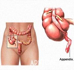 Аппендикс в организме, анатомия